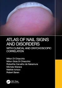 Atlas of Nail Signs and Disorders with Clinical an...