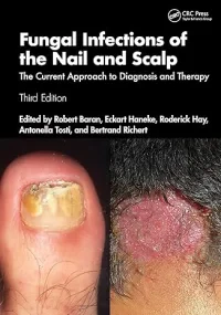Fungal Infections of the Nail and Scalp: The Curre...