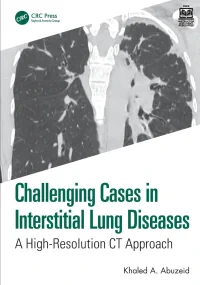 Challenging Cases in Interstitial Lung Diseases: A...