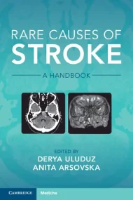 Rare Causes of Stroke: A Handbook