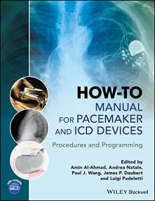 How-to Manual for Pacemaker and ICD Devices: Proce...