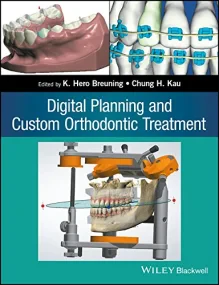 Digital Planning and Custom Orthodontic Treatment 