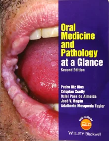 Oral Medicine and Pathology at a Glance (At a Glan...