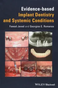 Evidence–based Implant Dentistry and Systemic Cond...