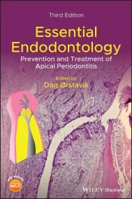 Essential Endodontology: Prevention and Treatment ...