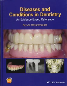 Diseases and Conditions in Dentistry: An Evidence–...