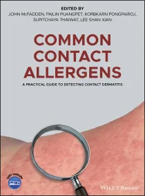 Common Contact Allergens: A Practical Guide to Det...