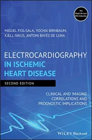 Electrocardiography in Ischemic Heart Disease: Cli...