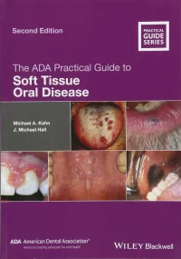 The ADA Practical Guide to Soft Tissue Oral Diseas...