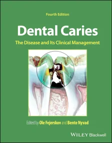 Dental Caries: The Disease and its Clinical Manage...