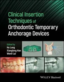 Clinical Insertion Techniques of Orthodontic Tempo...
