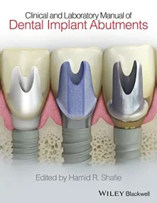 Clinical and Laboratory Manual of Dental Implant A...