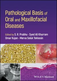 Pathological Basis of Oral and Maxillofacial Disea...