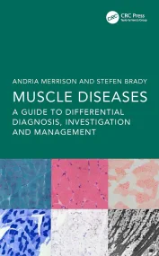 Muscle Diseases A Guide to Differential Diagnosis,...