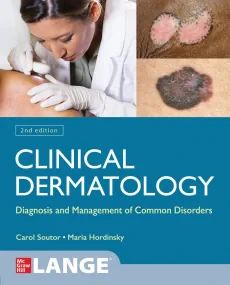 Clinical Dermatology