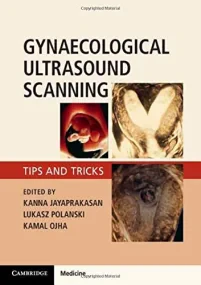 Gynaecological Ultrasound Scanning: Tips and Trick...