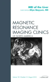 MRI of the Liver, An Issue of Magnetic Resonance I...