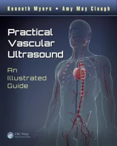 Practical Vascular Ultrasound: An Illustrated Guid...