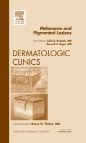 Melanoma and Pigmented Lesions, An Issue of Dermat...