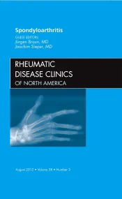 Spondyloarthropathies, An Issue of Rheumatic Disea...