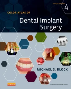 Color Atlas of Dental Implant Surgery, 4e