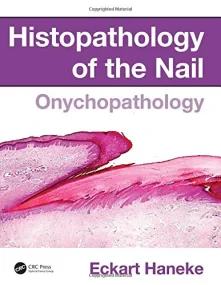 Histopathology of the Nail: Onychopathology