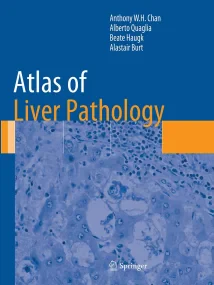 Atlas of Liver Pathology (Atlas of Anatomic Pathol...
