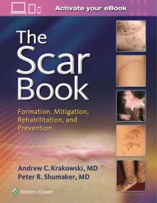 The Scar Book: Formation, Mitigation, Rehabilitati...
