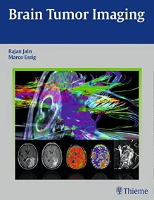 Brain Tumor Imaging