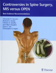 Controversies in Spine Surgery, MIS versus OPEN: B...