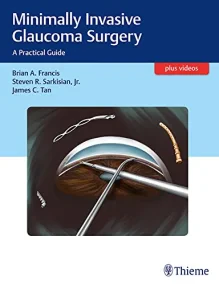 Minimally Invasive Glaucoma Surgery: A Practical G...