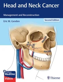 Head and Neck Cancer: Management and Reconstructio...