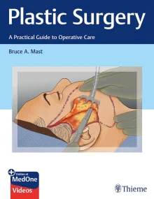 Plastic Surgery: A Practical Guide to Operative Ca...
