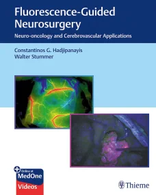 Fluorescence-Guided Neurosurgery: Neuro-oncology a...