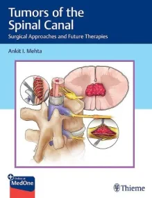 Tumors of the Spinal Canal: Surgical Approaches an...
