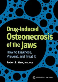 Drug-Induced Osteonecrosis of the Jaws: How to Dia...