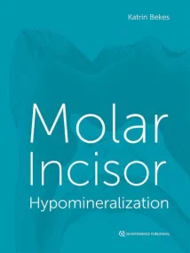 Molar Incisor Hypermineralisation