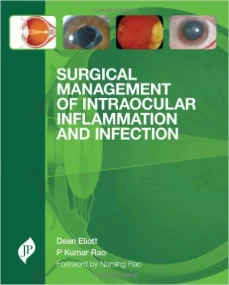 Surgical Management of Intraocular Inflammation an...
