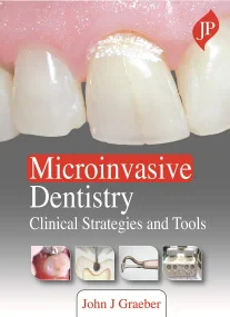 Microinvasive Dentistry: Clinical Strategies and T...