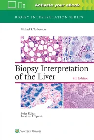 Biopsy Interpretation of the Liver 4th edition