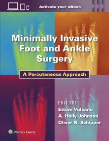 Minimally Invasive Foot and Ankle Surgery: A Percu...