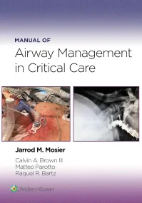 Manual of Airway Management in Critical Care