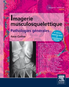 Imagerie musculosquelettique : pathologies général...