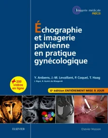 Échographie et imagerie pelvienne en pratique gyné...