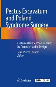 Pectus Excavatum and Poland Syndrome Surgery: Cust...