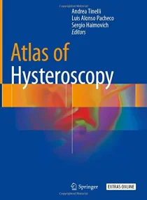 Atlas of Hysteroscopy 