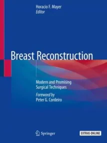 Breast Reconstruction: Modern and Promising Surgic...