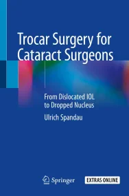 Trocar Surgery for Cataract Surgeons: From Disloca...