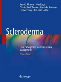 Scleroderma: From Pathogenesis to Comprehensive Ma...