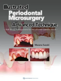 Illustrated Advanced Technique of Periodontal Micr...